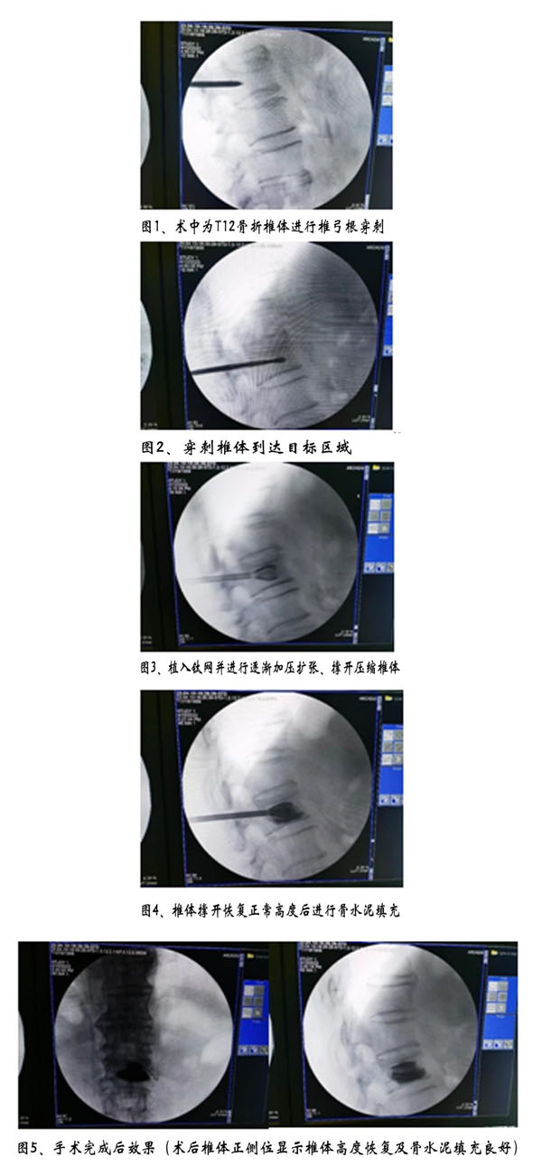 1681800738145394.jpg 微信图片_20230418144553.jpg