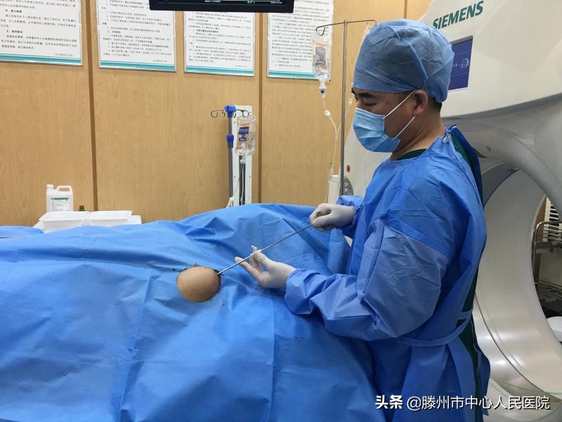 CT引导微波消融联合钢筋混凝土技术治疗肱骨转移技术在滕州开展